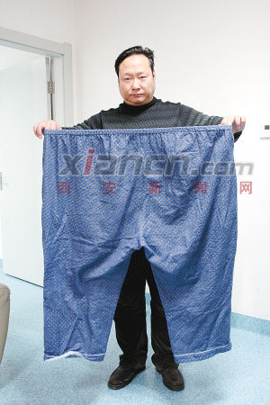 260公斤小伙西安切胃减肥 手术切掉约四分之三